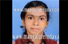Kasargod: 8 yr girl injured in Hosangady accident succumbs